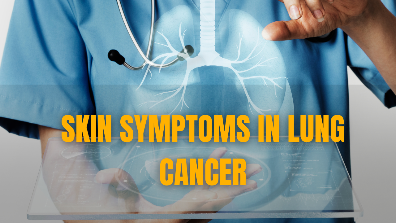 Skin Symptoms in Lung Cancer