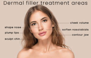 Dermal Filler Treatment Areas - When To Use Dermal Filler