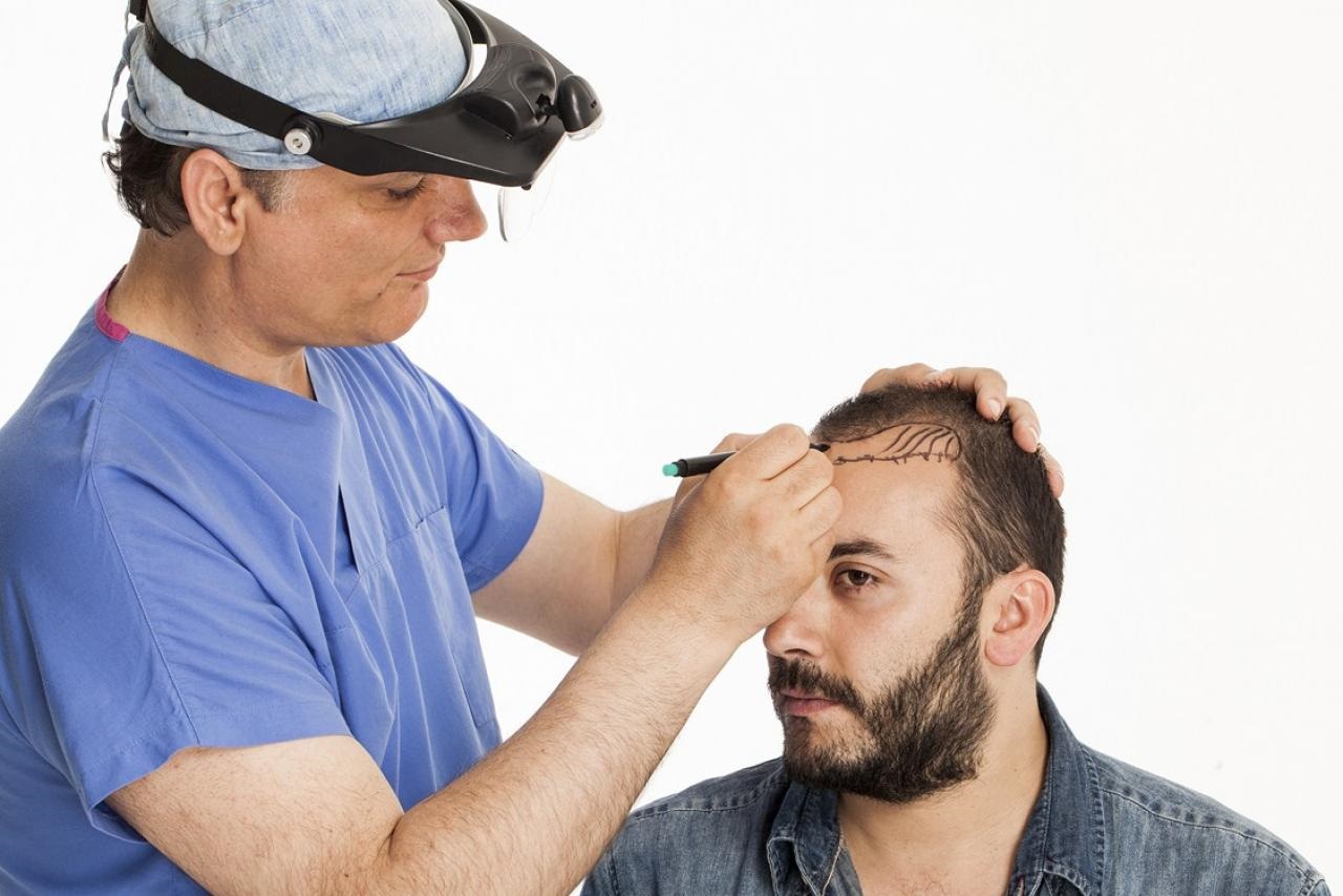 hair transplant cost