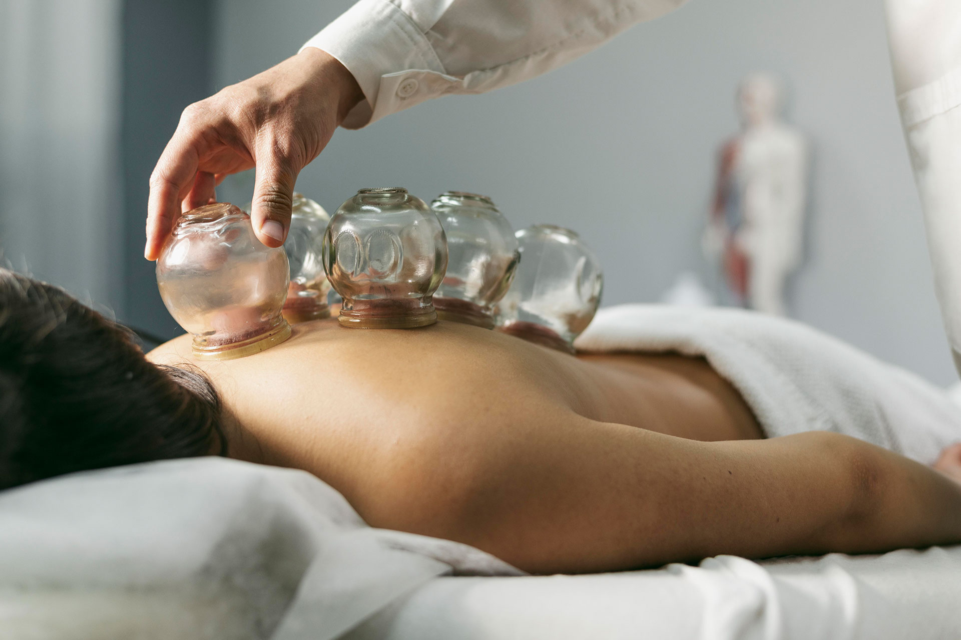 Best Cupping Therapy in Raleigh