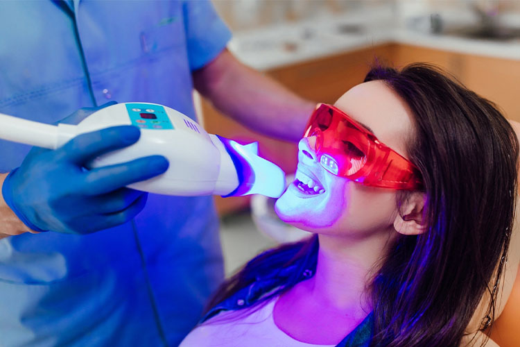 laser teeth whitening