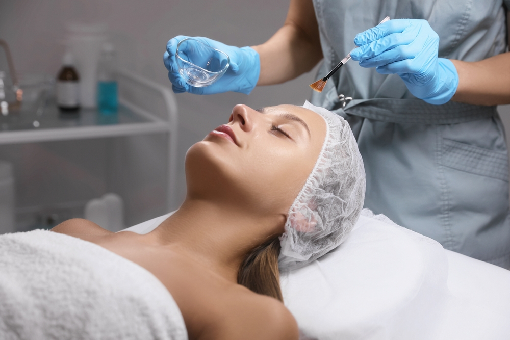 Chemical Peel