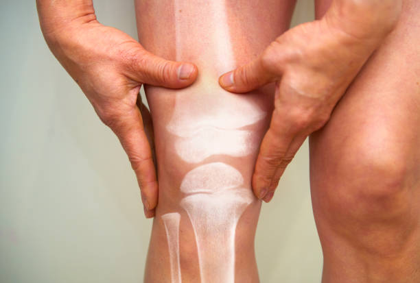 Supplements for Knee Health