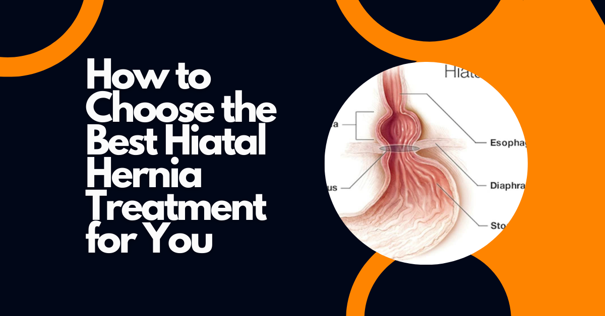 hiatal hernia treatment