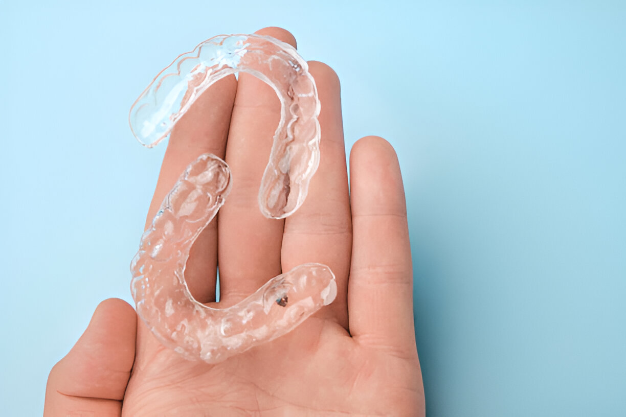 Invisalign Guide